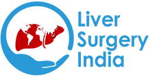 Liver Surgery India